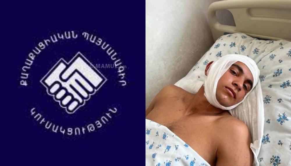 «ՔՊ-ի աջակից բանդան երկաթե մահակներով ծեծել է 16-ամյա անչափահասին». ահազանգ