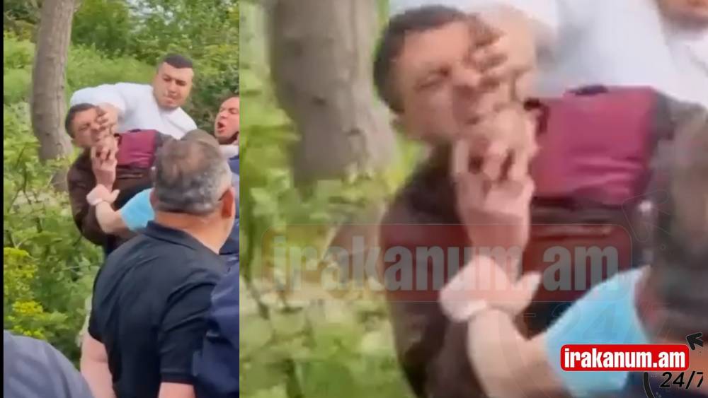 Քաղաքացիական հագուստով ոստիկանը մատերը մտցնում է ակցիայի մասնակցի աչքը