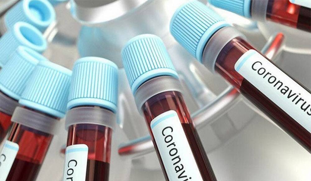Կորոնավիրուսով վարակման 134 նոր դեպք մեկ օրում. մահացել է 2 մարդ