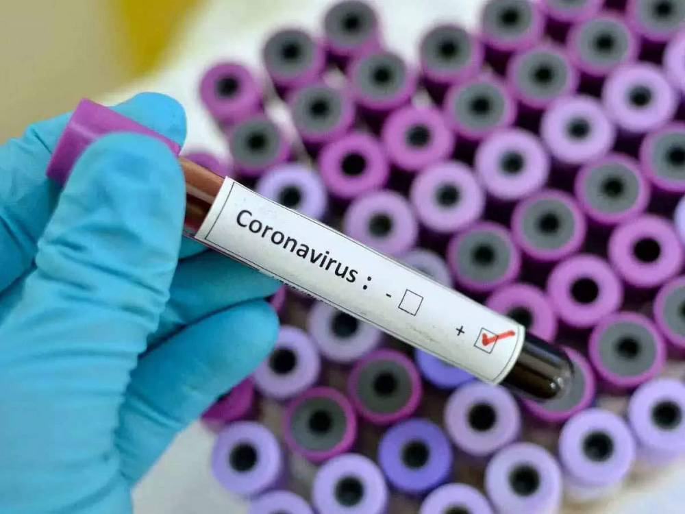 Մեծ Բրիտանիայում երկրորդ օրն անընդմեջ կորոնավիրուսով վարակման ցուցանիշը գերազանցում է 3000-ը