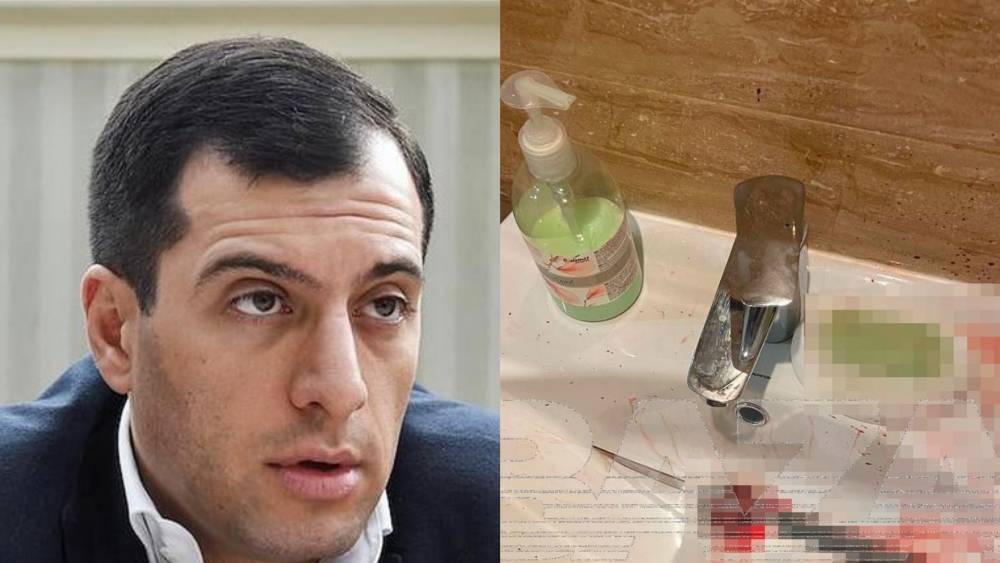 (Լուսանկարներ 21+ ) Բորիս Ավագյանի մահվան վայրից